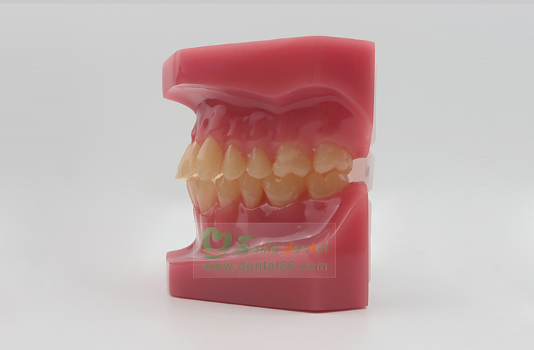 TM-B6 Orthodontic Model